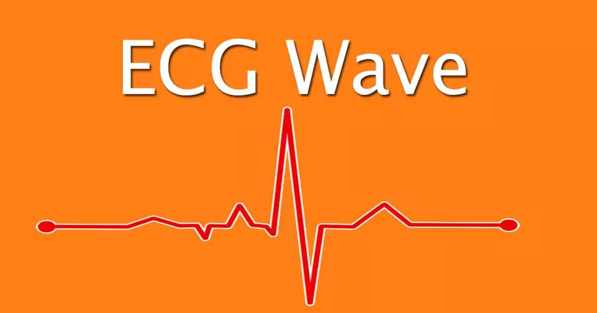 ECG wave explained, I love Veterinary