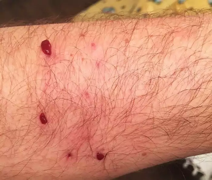 human hand cat bite