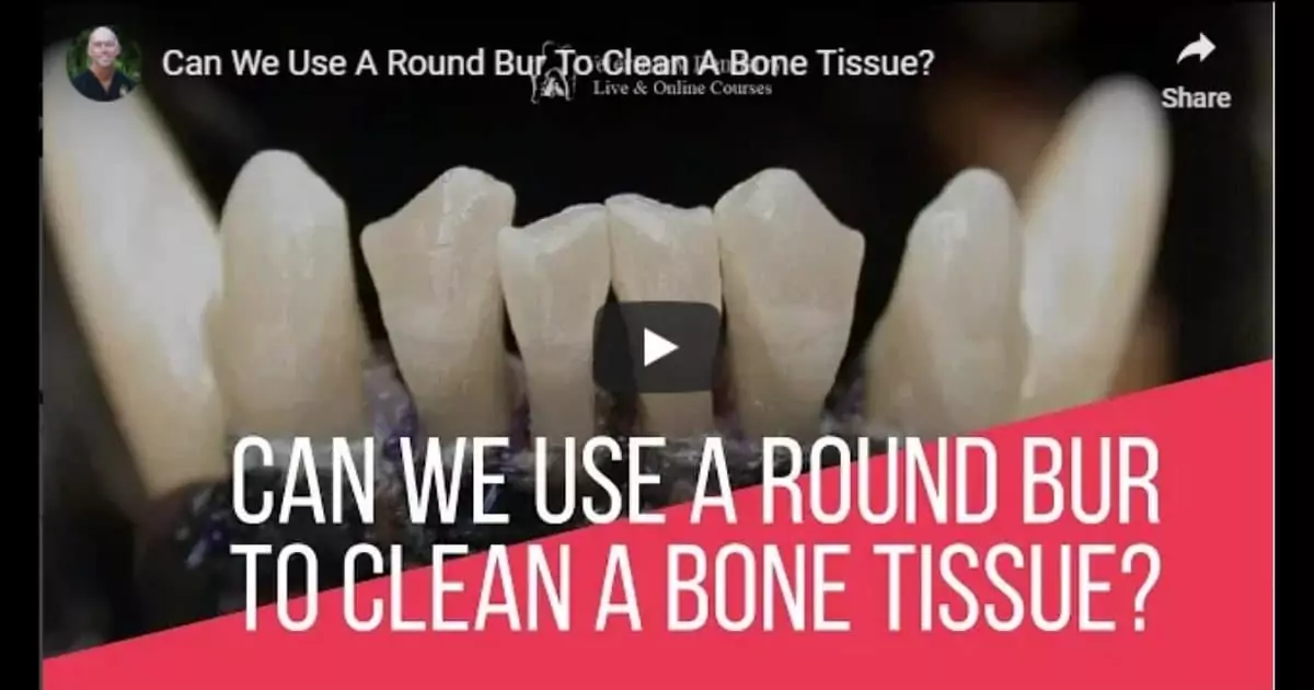 A Round Bur To Clean A Bone Tissue