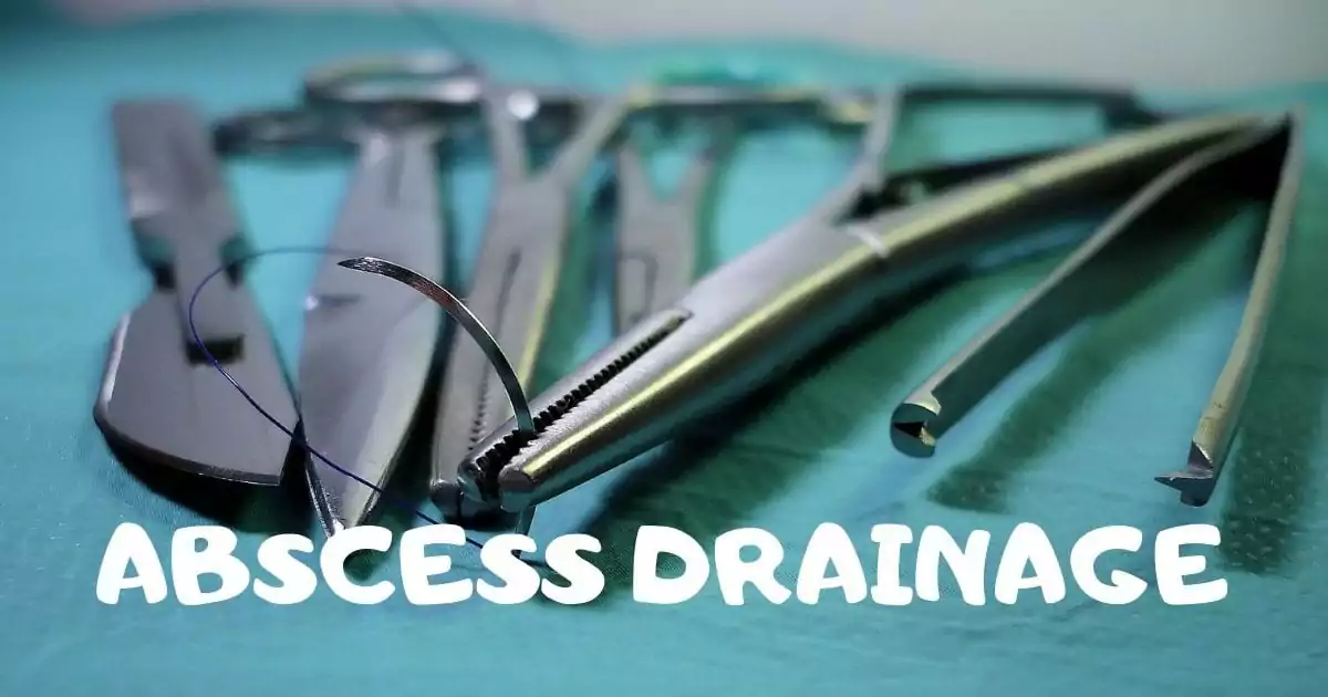 Abscess drainage video