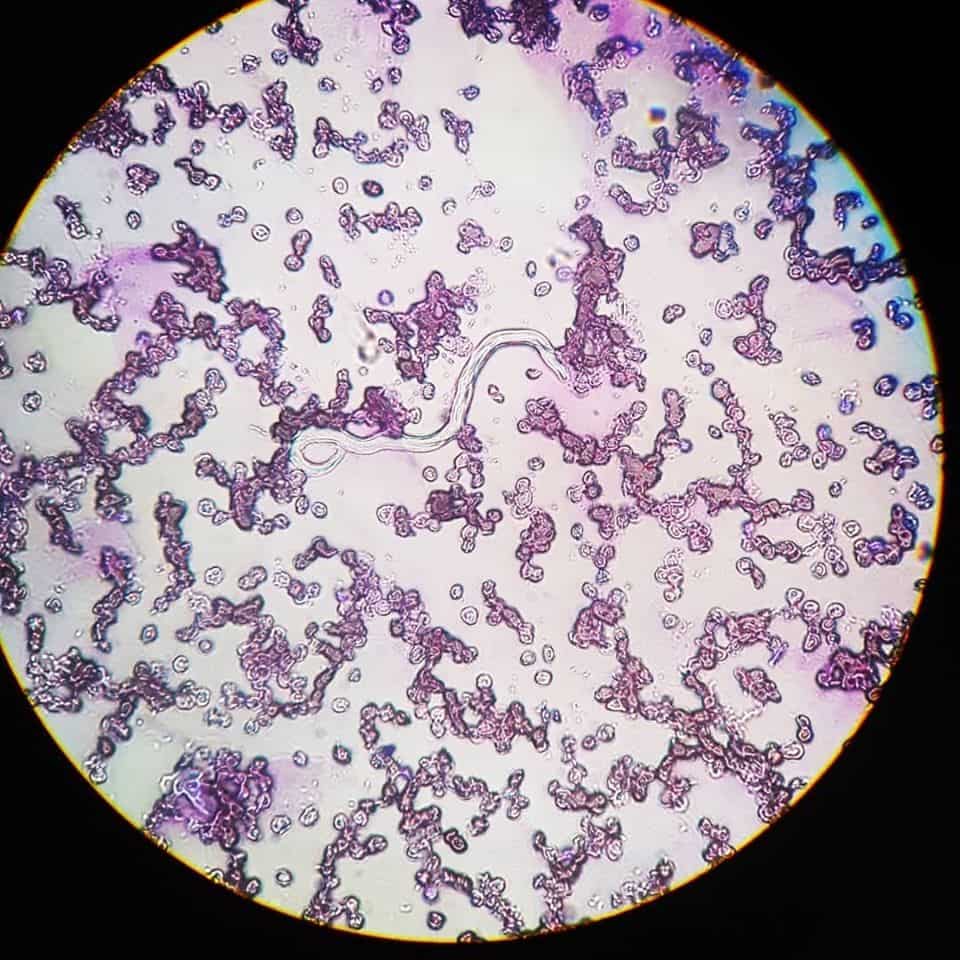 heartworm in dogs, blood smear by I Love Veterinary 