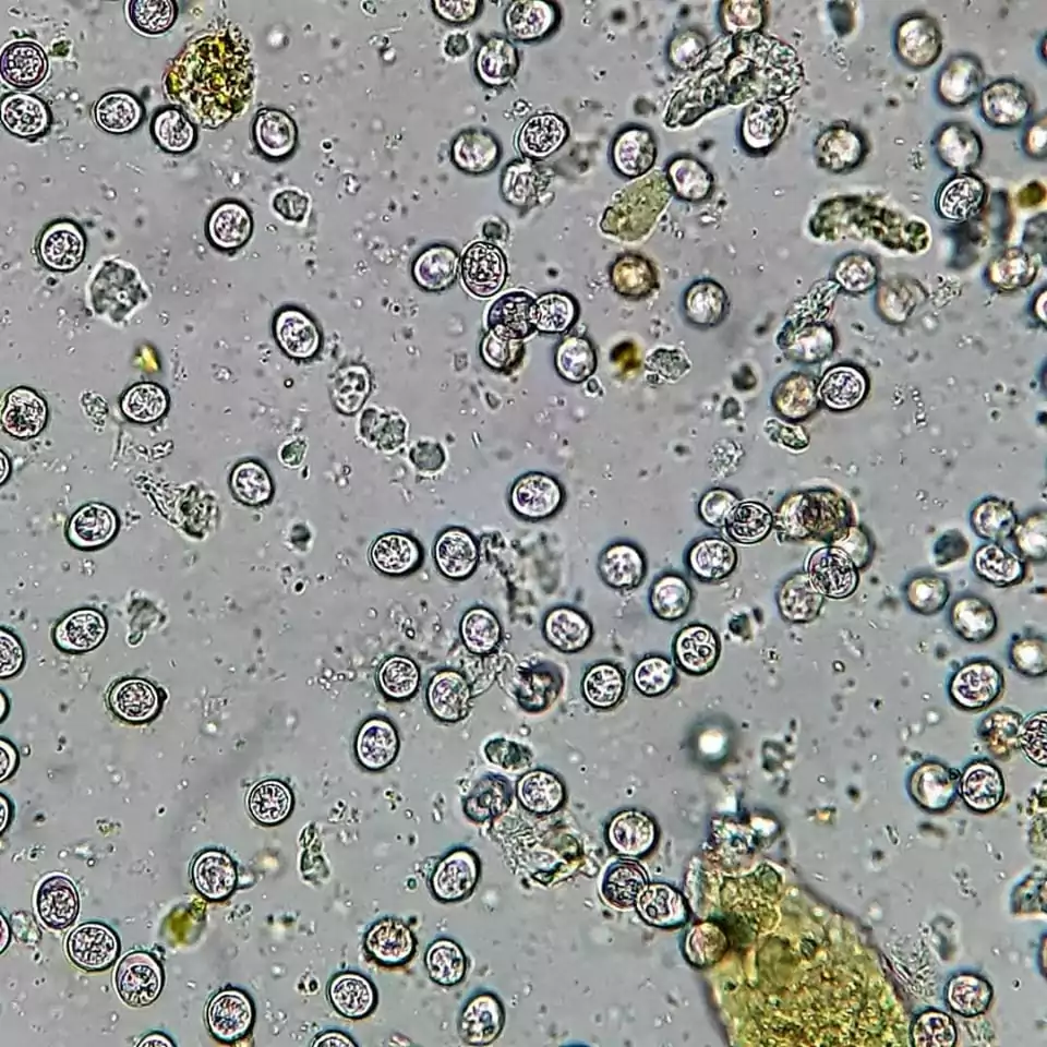 toxoplasma gondii under microscope, by I Love Veterinary
