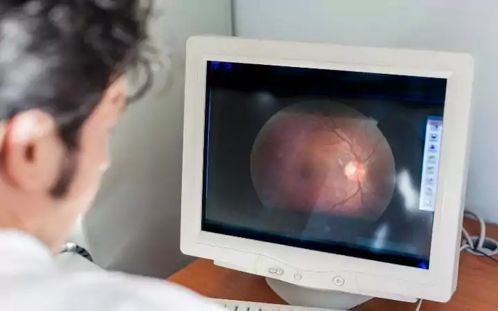 Veterinarian ophthalmologist looking at a retina scan, Cataracts in Dogs - I Love Veterinary