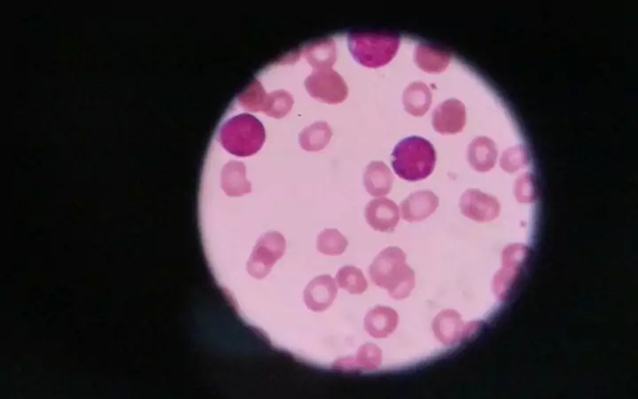 Blood smear, Unpacking the Symptoms, Treatments and Causes of IMHA - I Love Veterinary