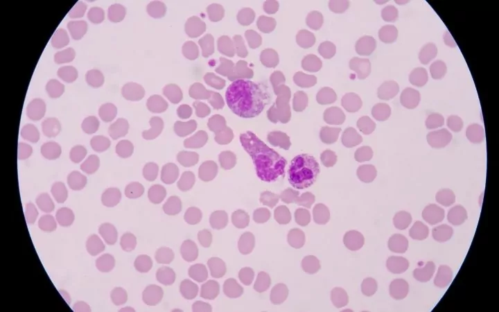 Blood smear from sepsis septicemia - I Love Veterinary