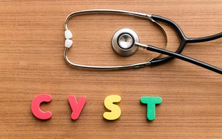 Spelled cyst word with stethoscope above it - I Love Veterinary