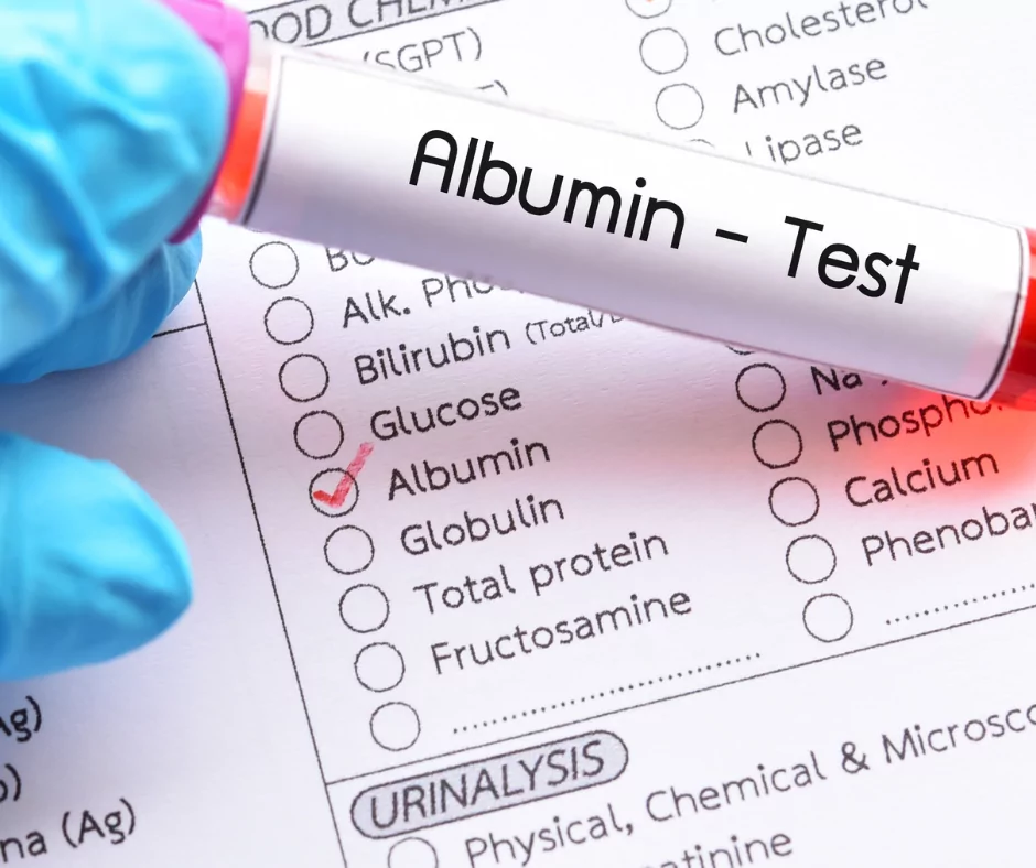albumin test