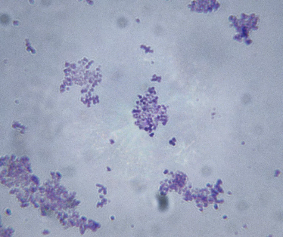 staphylococcus bacteria under a microscope
