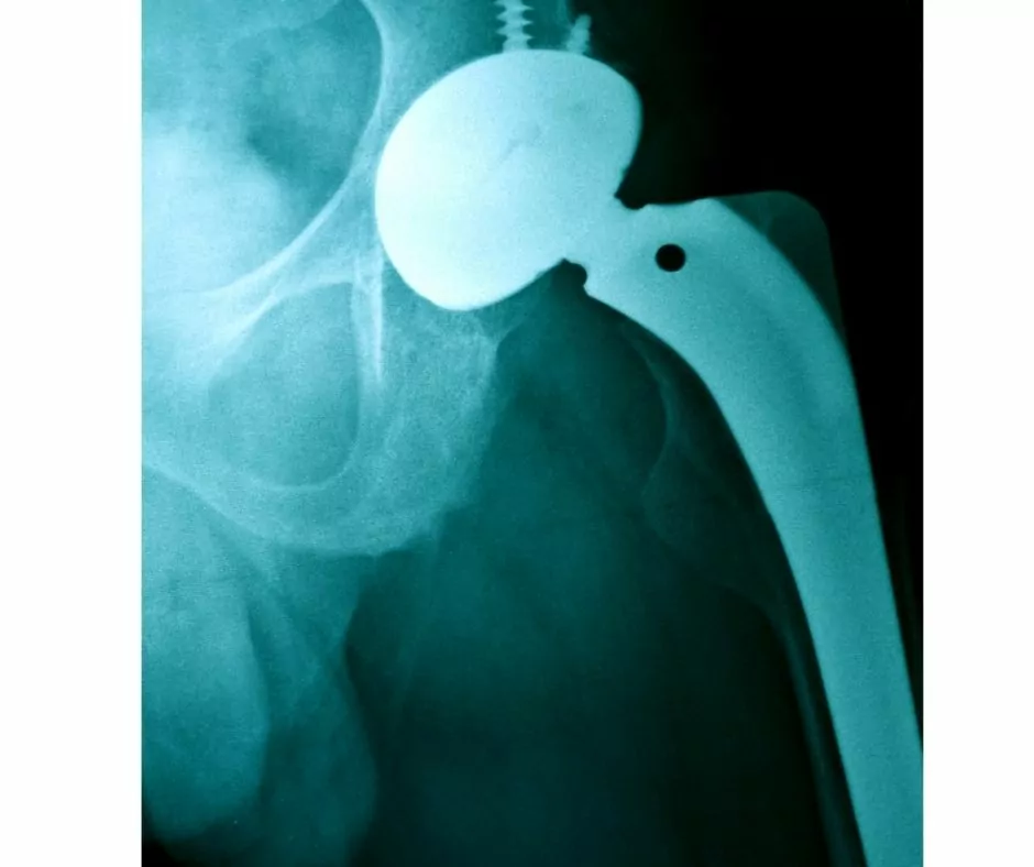 xray of hip replacement in large dog breed