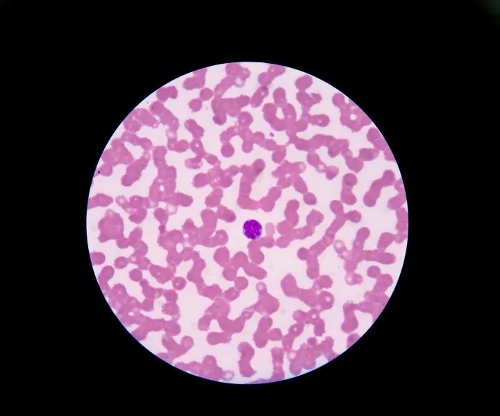 blood smear under the microscope