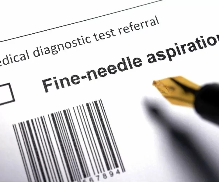 fine needle aspirate