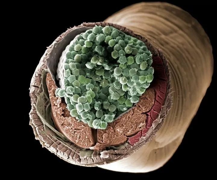 round worm eggs under microscope