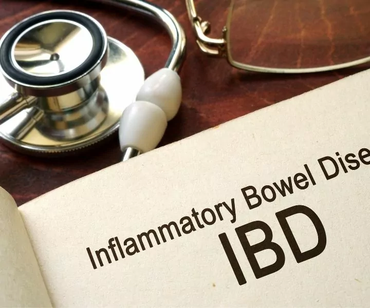 inflammatory bowel disease image