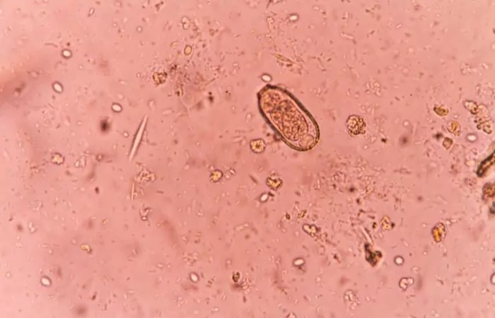 microscopic view of external parasites 