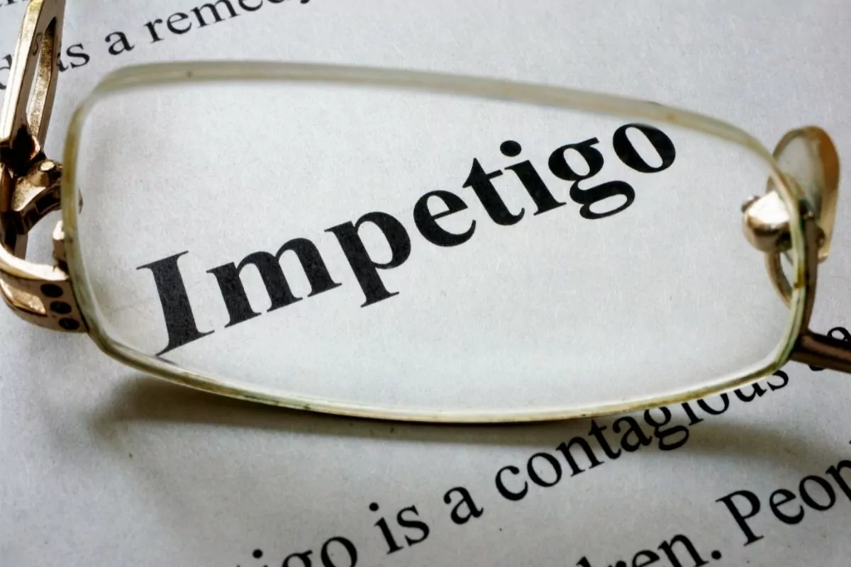 word Impetigo