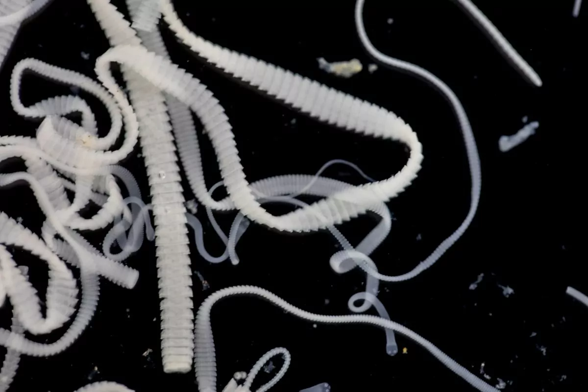 a microscopic image of a group of white tapeworms