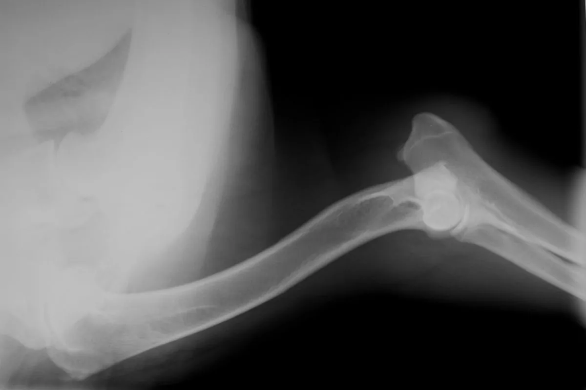 X-ray of dog shoulder and elbow