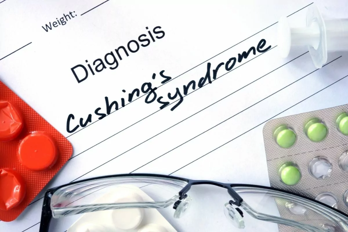 diagnosis Cushings syndrome 