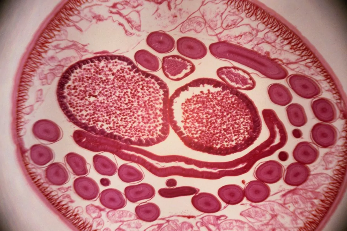 Microscopic image of roundworms