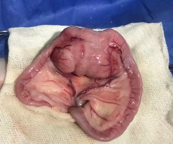 Picture of a tumor inside a dog's small intestine during surgery