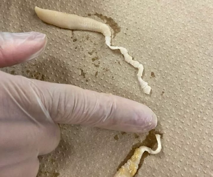 Tapeworms vomited by a cat examined by a veterinarian