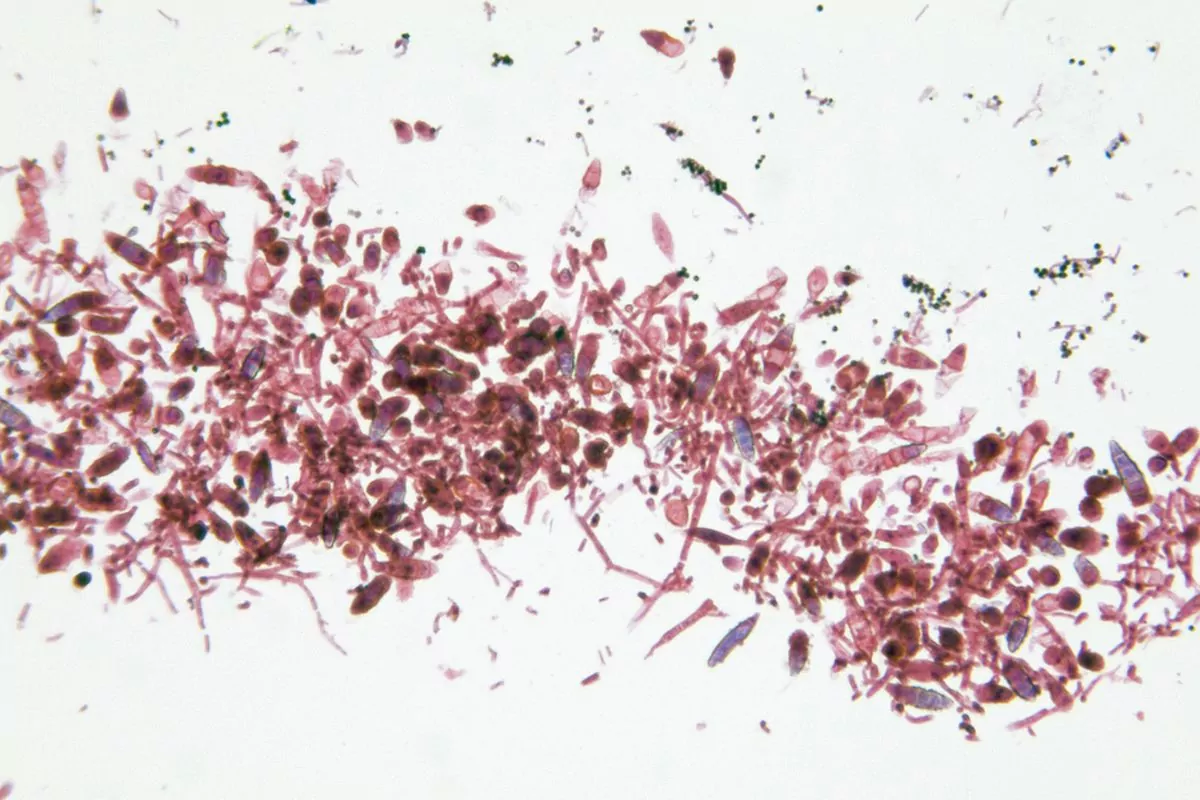 Microsporum canis